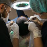 The Best Hair Transplant Clinic in Turkey 2022