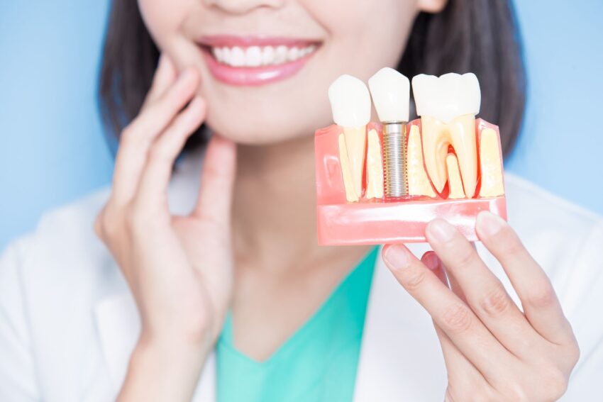 The Most Effective Countries To Have Dental Implants Abroad
